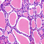 Biología Celular y Molecular de la célula folicular tiroidea